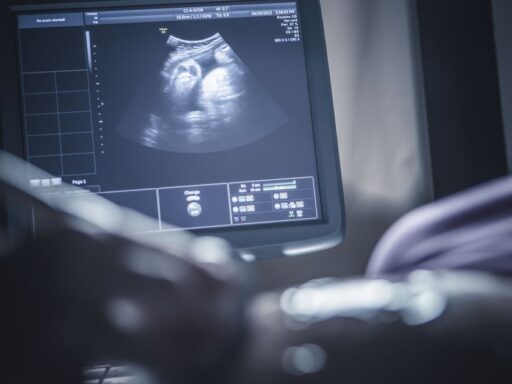 Representação médica de uma placenta humana com sinais de insuficiência.