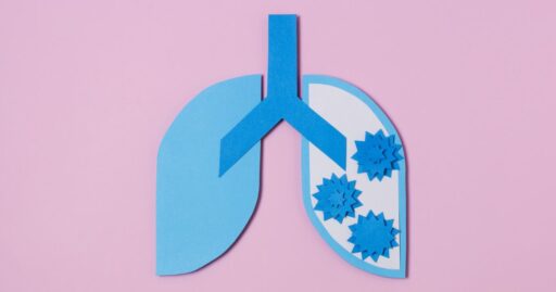 Gráfico de eficácia do medicamento Lorbrena no tratamento de câncer de pulmão.